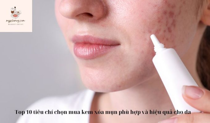 Top 10 tiêu chí chọn mua kem xóa mụn phù hợp và hiệu quả cho da